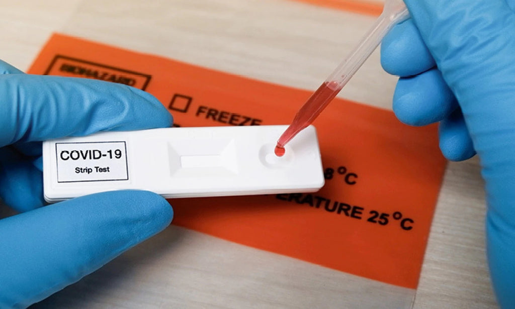 Testing Strategies for SARS-CoV-2